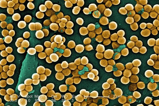 800px-CDC-10046-MRSA